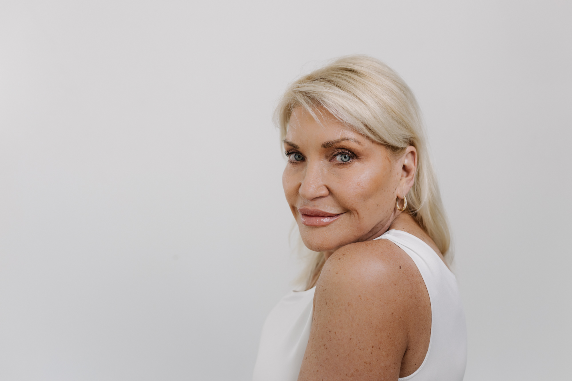 Woman with refined facial contours after deep plane facelift rejuvenation.